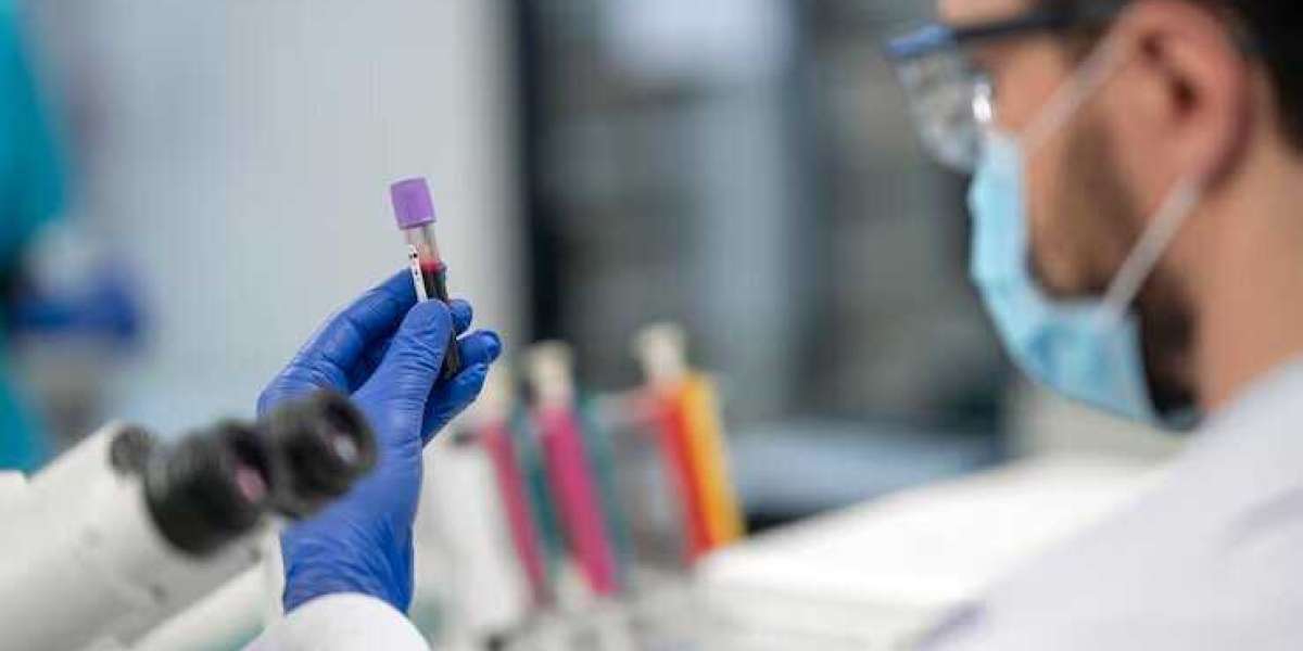 Covid Antibody Test Cost