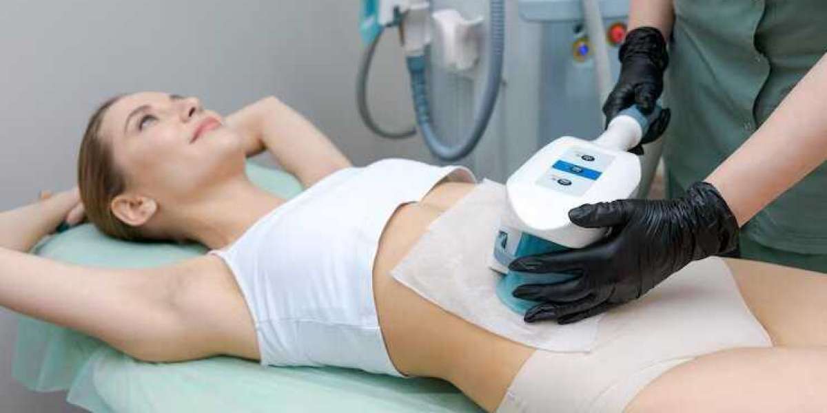 Affordable Coolsculpting Near Me
