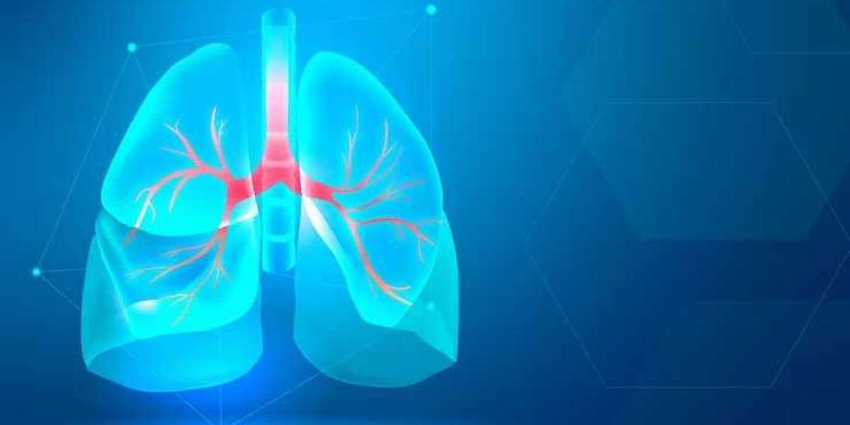 Are you Looking for Best Lung Cancer Treatment in Gurgaon?