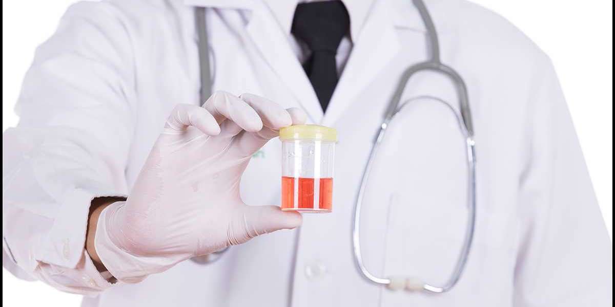Blood in Urine: Can It Resolve Itself Naturally?
