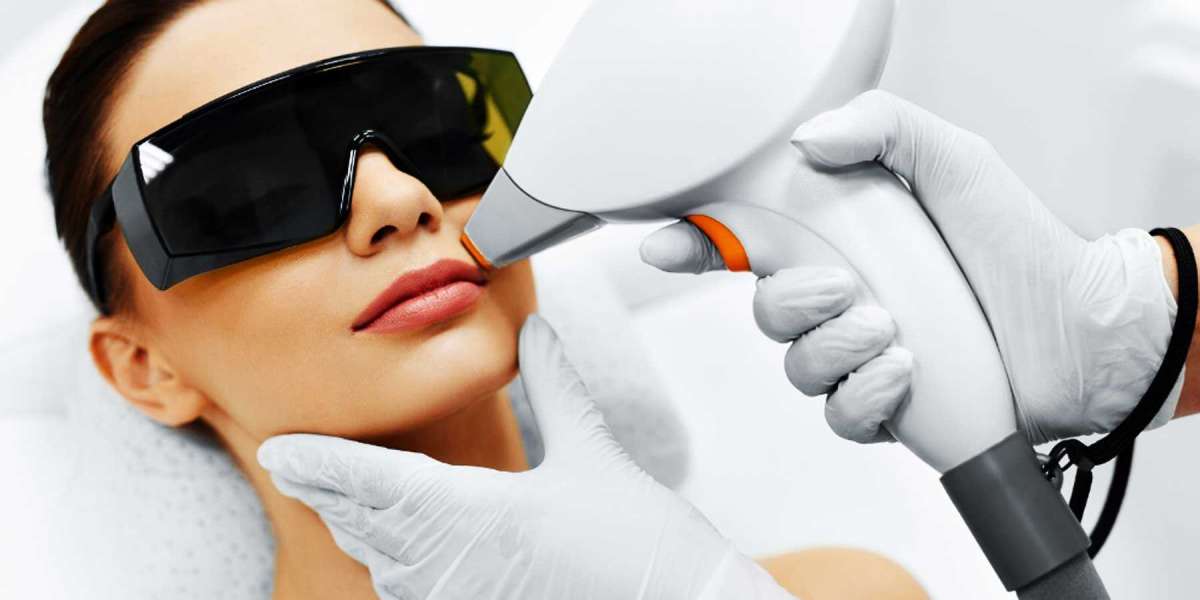 Why Should You Consider Laser Hair Removal in Louisiana?