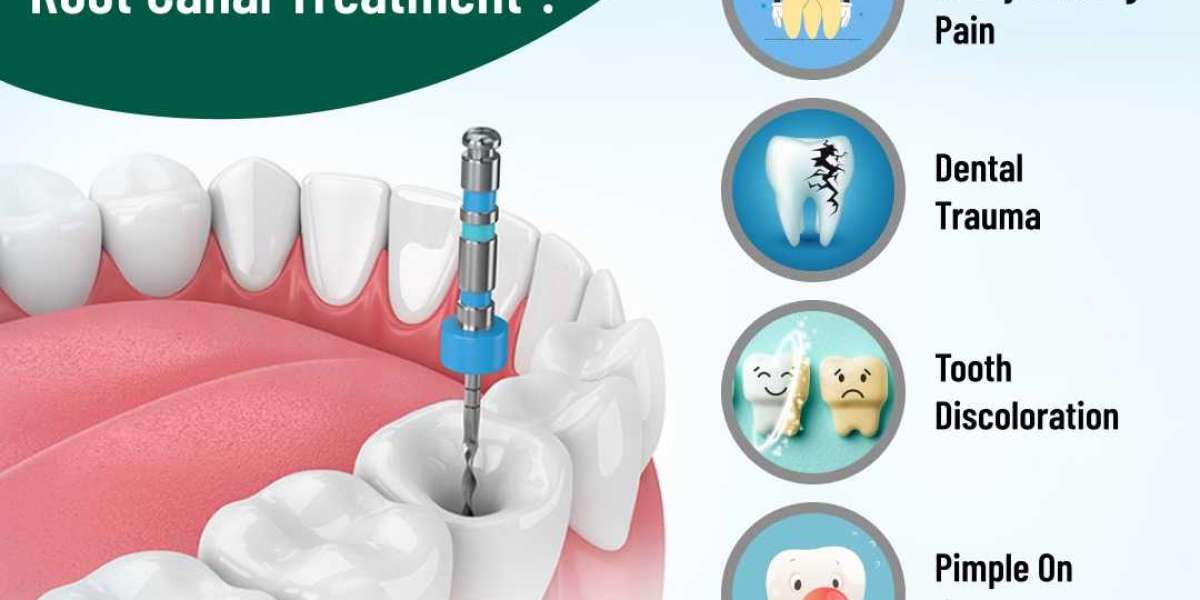 Discover Painless Root Canal Treatment in Bangalore